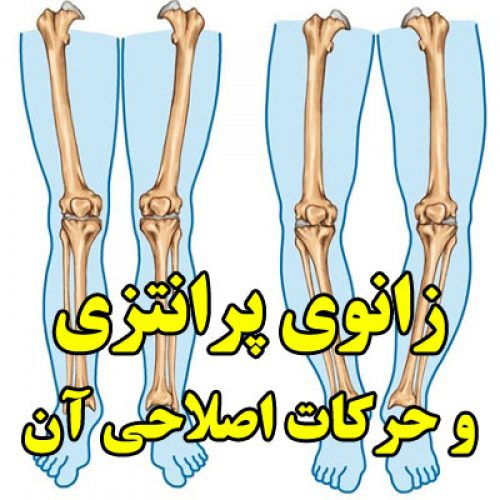 تحقیق در مورد زانوی پرانتزی و حرکات اصلاحی آن